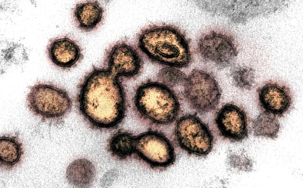 Lee más sobre el artículo Hallan en Francia una nueva variante del coronavirus con 46 mutaciones